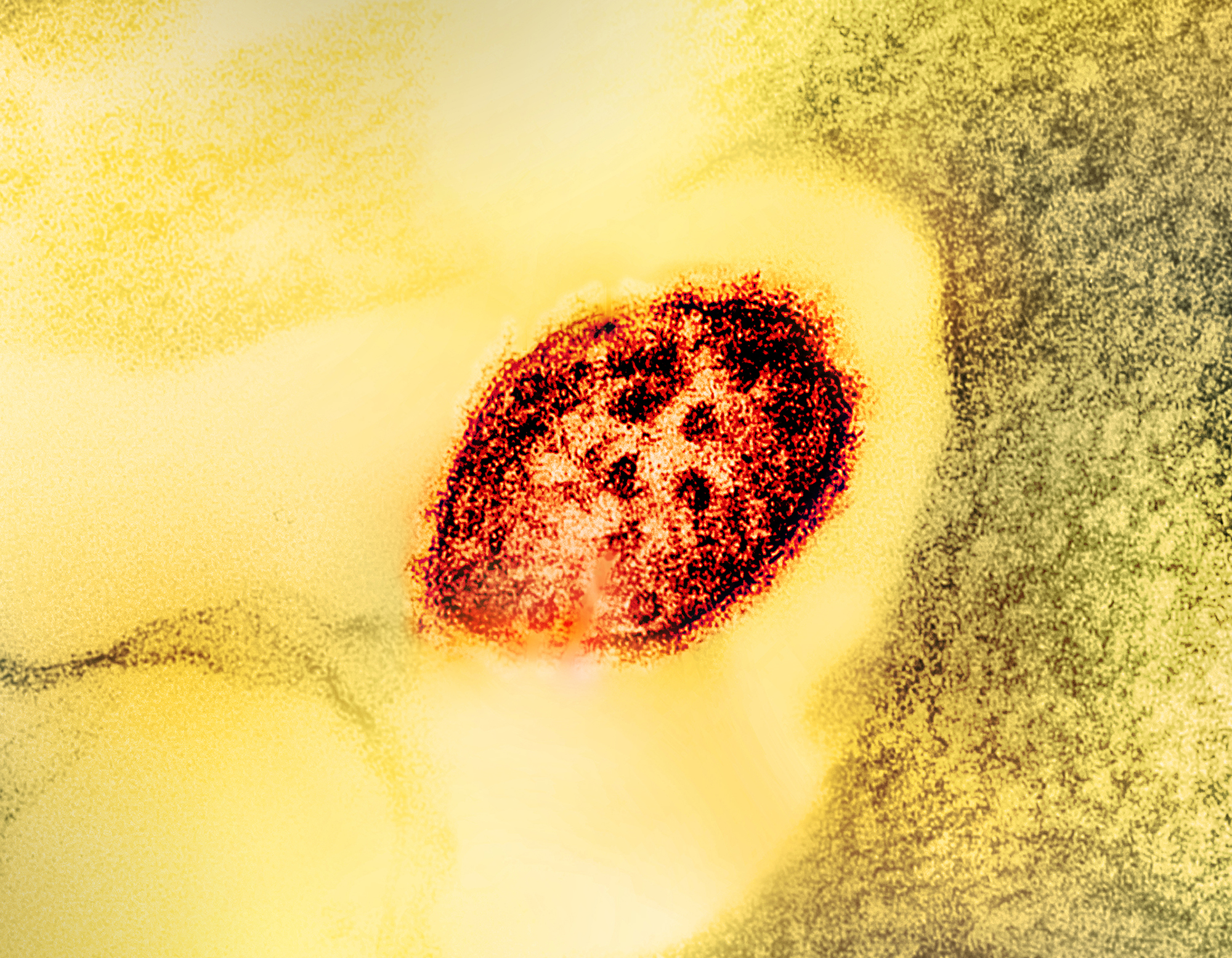 Measles virus
