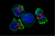 Killer T cells surround a cancer cell