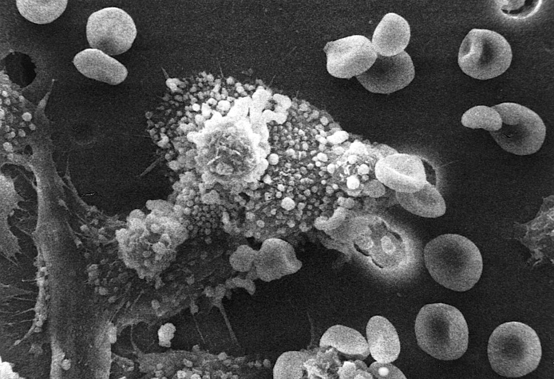 Macs killing cancer cell