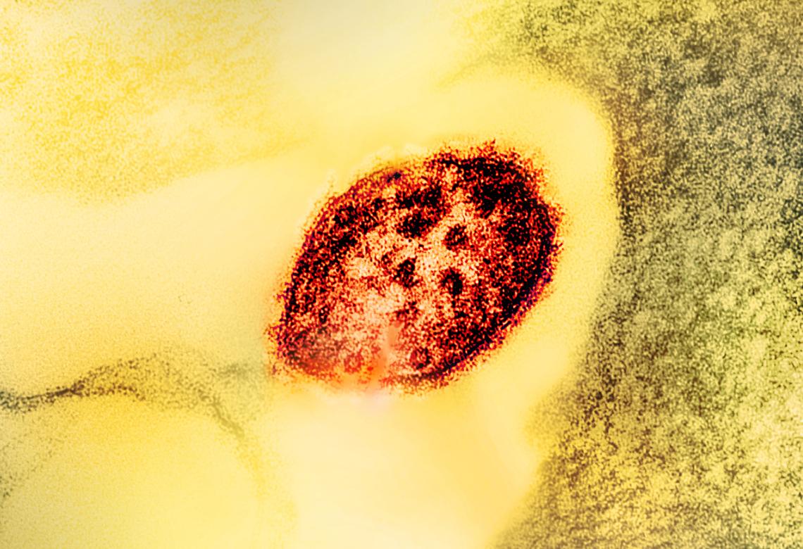 Measles virus